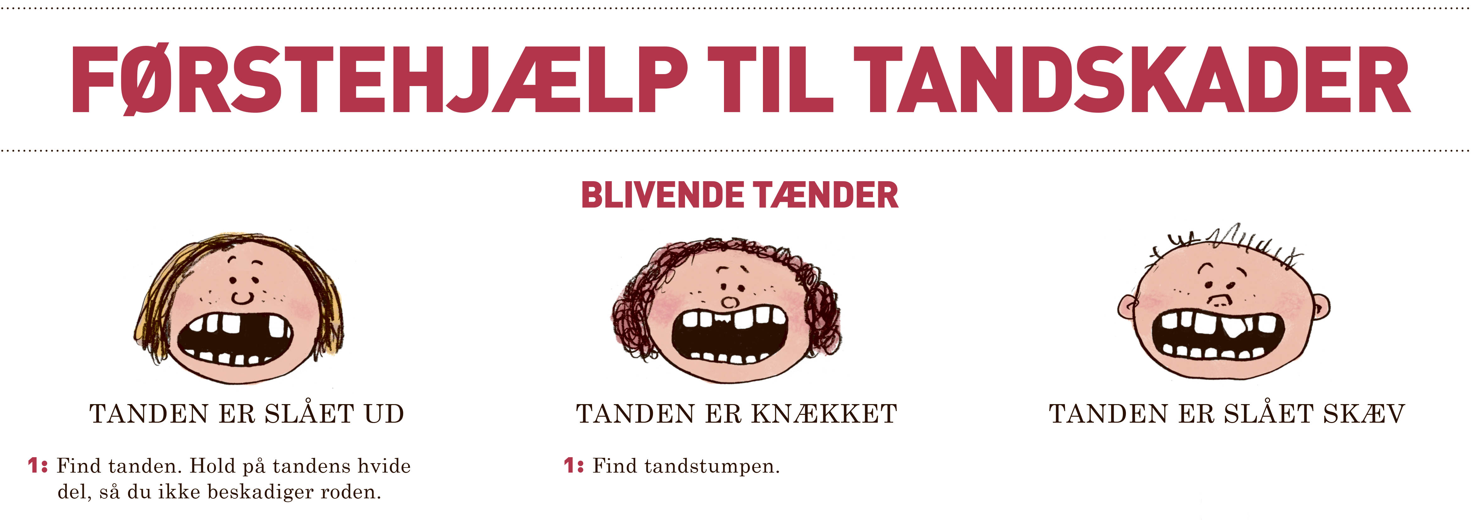 Førstehjælp til tandskader 1
